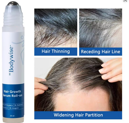 Aceite Ginger para el crecimiento del cabello raíces del cabello y cuero cabelludo Sérum para la caída del cabello Roller